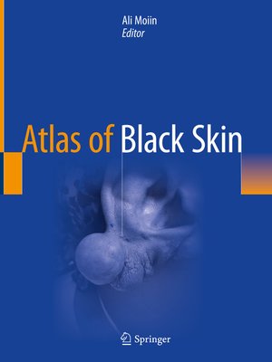 cover image of Atlas of Black Skin